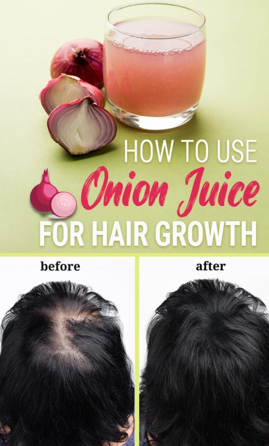 Hair  Treatment   How To Use Onion Juice For Hair