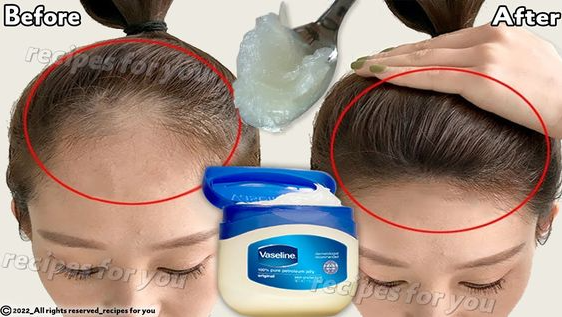 Hair Growth Treatment   How To Use Vaseline For Double Hair Growth, Your Hair Will Grow 3 Times